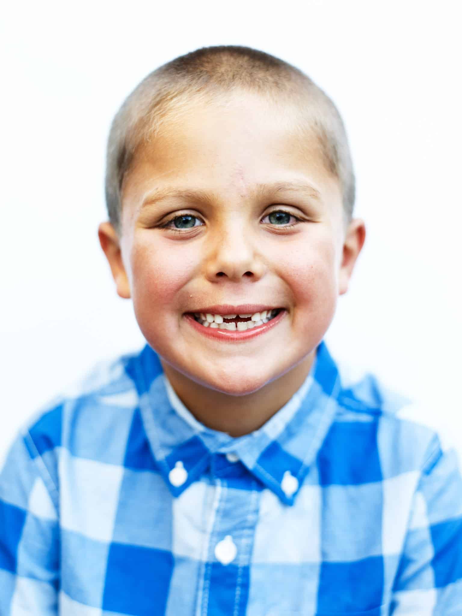 boy with missing teeth posing for potrait